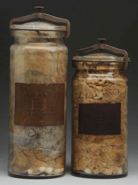 LOT OF 2: VERY EARLY BANDAGE JARS.                